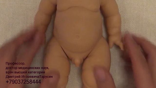 Осмотр новорожденного врачом андрологом урологом