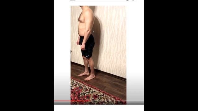 Отзыв Дмитрия. Боль в спинеЛевая грушевидная больГрыжа