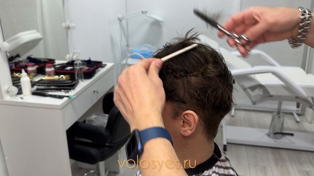 Система волос Москва