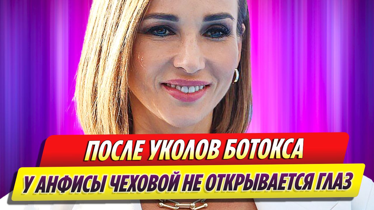 У Анфисы Чеховой не открывается один глаз из-за уколов ботокса