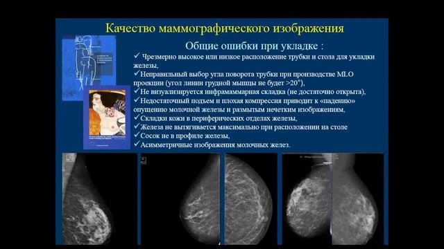 Шумакова Т.А. Принципы и критерии качества маммографического исследования