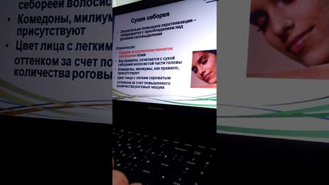 Определяем тип себореи.