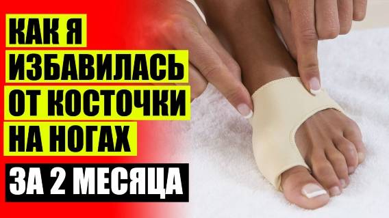 🤥 Шишки на ногах как избавиться ❗ Убрать шишки на ногах отзывы 🔔