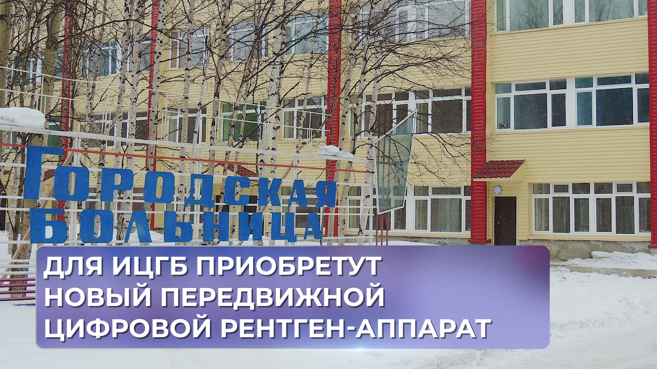 Для ИЦГБ приобретут новый передвижной цифровой рентген-аппарат