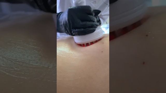 LPG массаж. Кавитация. Вибромассаж.  Биофотон. Прессотерапия. Миостимуляция.RF-лифтингПавлодар