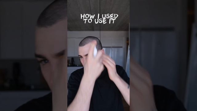 Do you use minoxidil? #shorts #minoxidil #hairloss