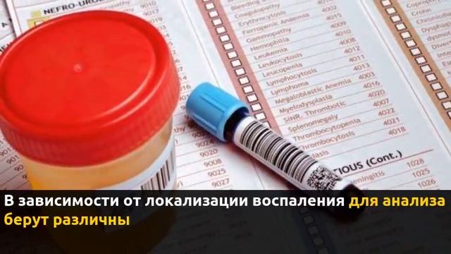 Бак посев с определением чувствительности к антибиотикам