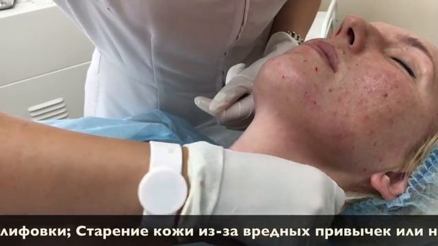 Как увлажнить кожу и подготовить ее к отпуску
