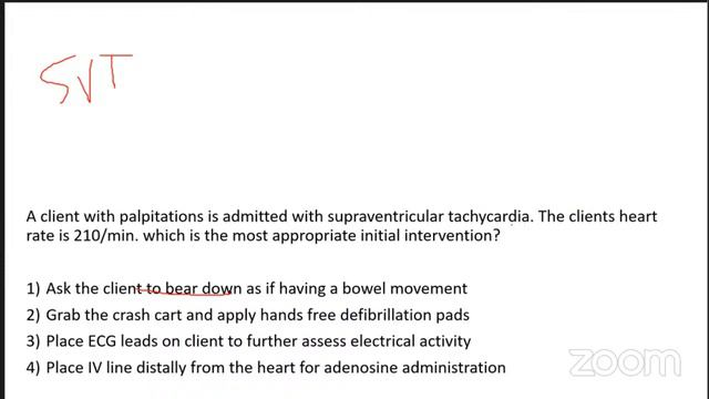 NCLEX ECG QUIZ REVIEW