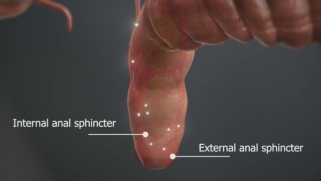 Constipation | The GutDr Explains (3D Gut Animation)