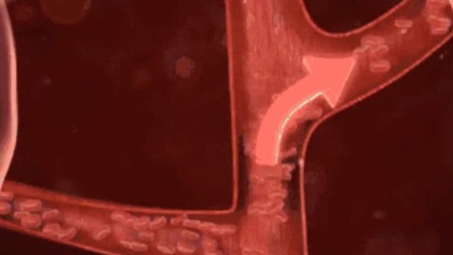 Упражнение для предотвращения Лимфостаза