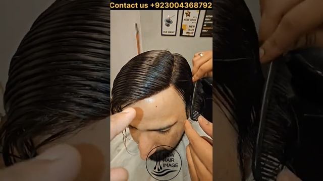 Q6 Hair Patch: Natural Front Hair Line Patch #hairpatch #hairreplacement
