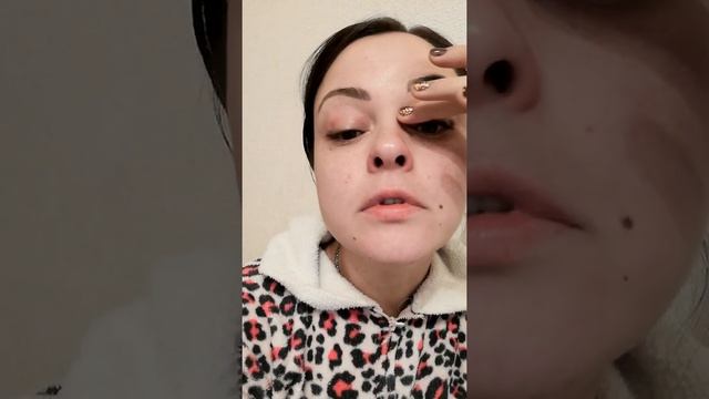 ❗?Никотиновая кислота❗/Я опухла!?/Что  может пойти не так????