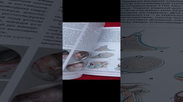 Спортивное плечо. В 3 томах. Том 1. Нестабильность плечевого сустава