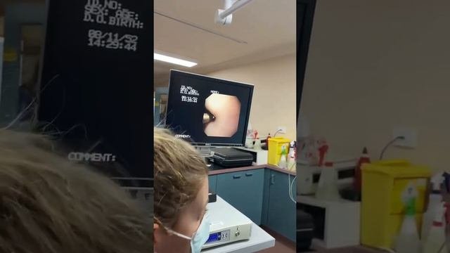 Endoscopic Removal Of Gastric Foreign Body From A Cat