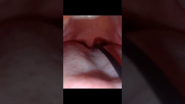 Time to swallow earphones (◡ ω ◡) ?