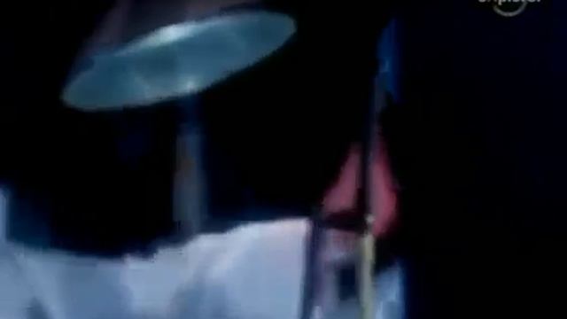Жесть! Пересадка головы. Уникальные медицинские эксперименты
