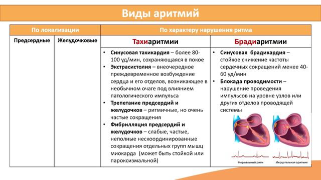 3.1. Патологии сердечно-сосудистой системы. Аритмии