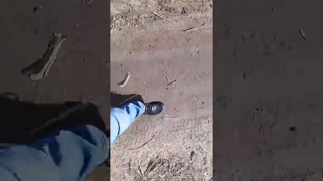 Перелом пятки