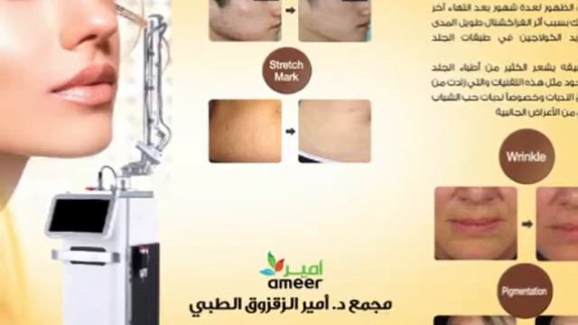 سناب اون سمايل قبل وبعد|عروض خاص🔥من مجمع الدكتور أمير الزقزوق الطبي في الخبر