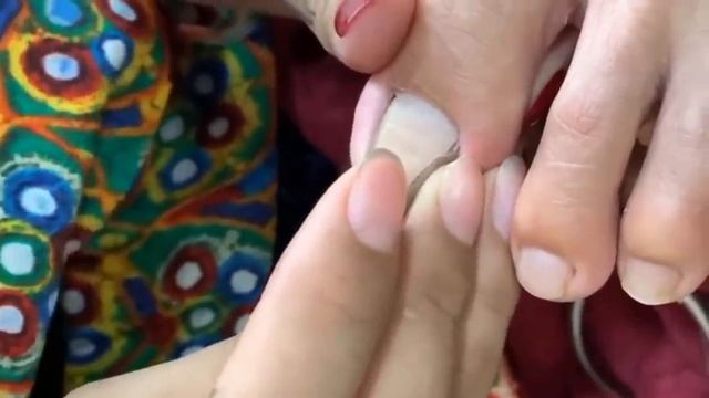 HOW TO CUT THICK TOENAILS  - Toenail Cleaning Satisfying #22