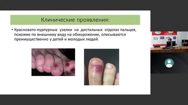 Вебинар для врачей ПМСП 11.05.2021 13:45