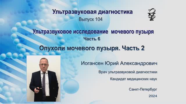 УЗИ. Доктор Иогансен. Выпуск 104. Опухоли мочевого пузыря. Часть 2.