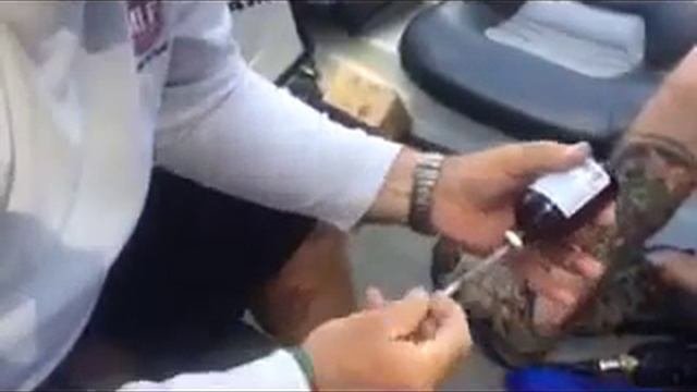 Selfie Hook Removal Part 1 - Lidocaine Injections
