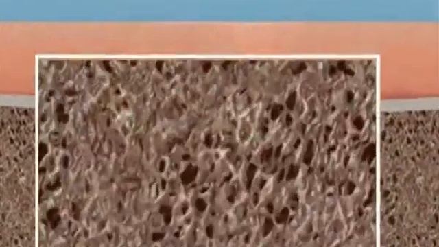 dacogen hypomethylation dvdrip rus