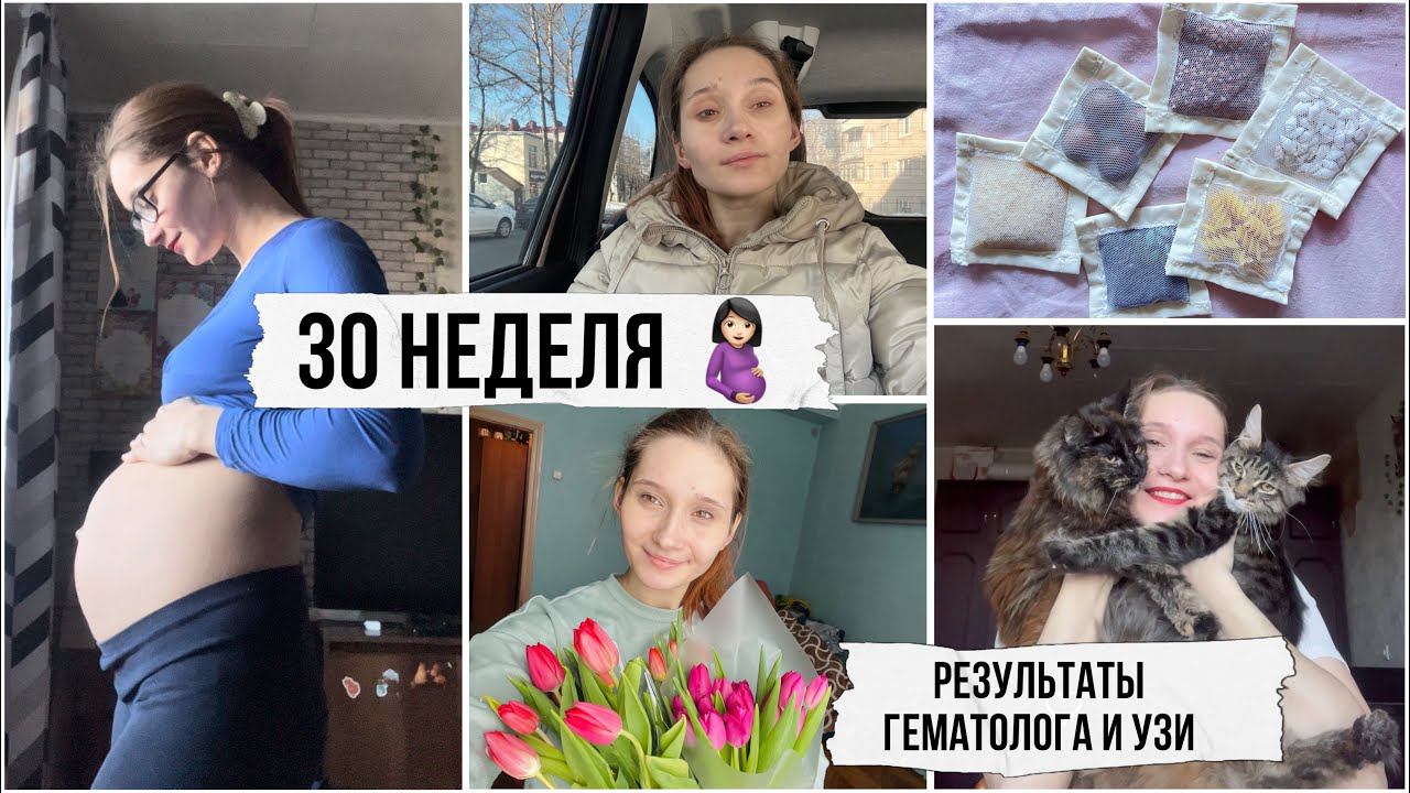 30 недель беременности  Гематолог, УЗИ 3-й триместр, декрет