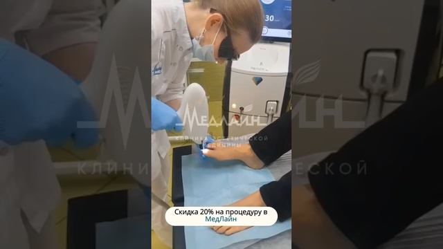 МедЛайн Лазерное лечение грибка ногтей