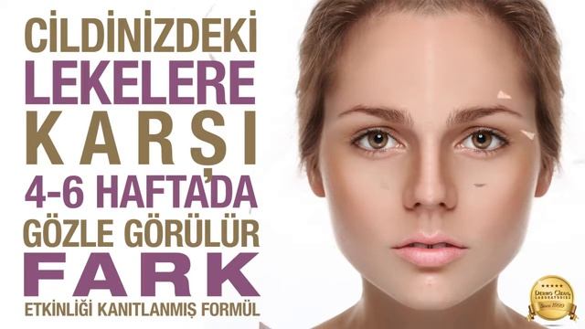Pigmentone Leke Giderici Krem-2020