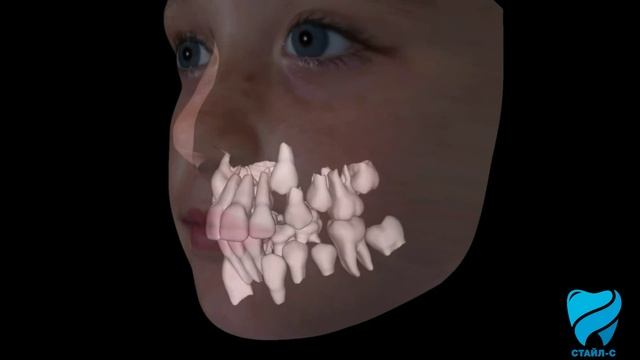 Как происходит смена зубов и прикуса у детей - наглядно