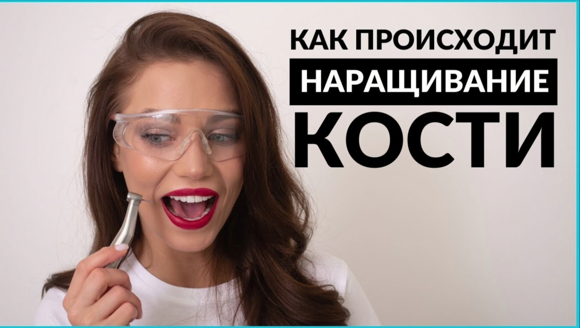 Что такое наращивание кости. Как происходит синус-лифтинг