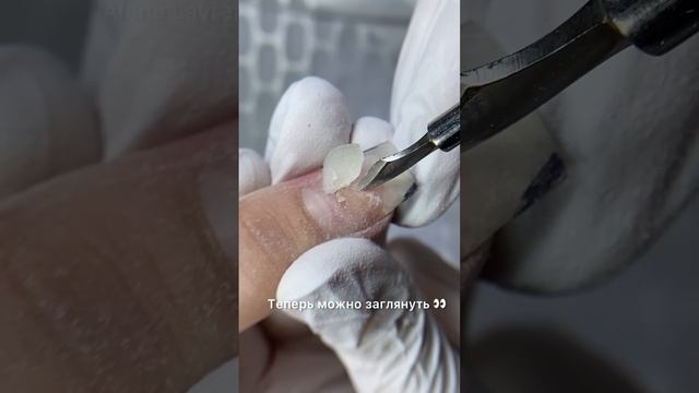 Как работать с отслойками? Отслойки что делать? Как снять отслойки? #Nails #маникюр #отслойки