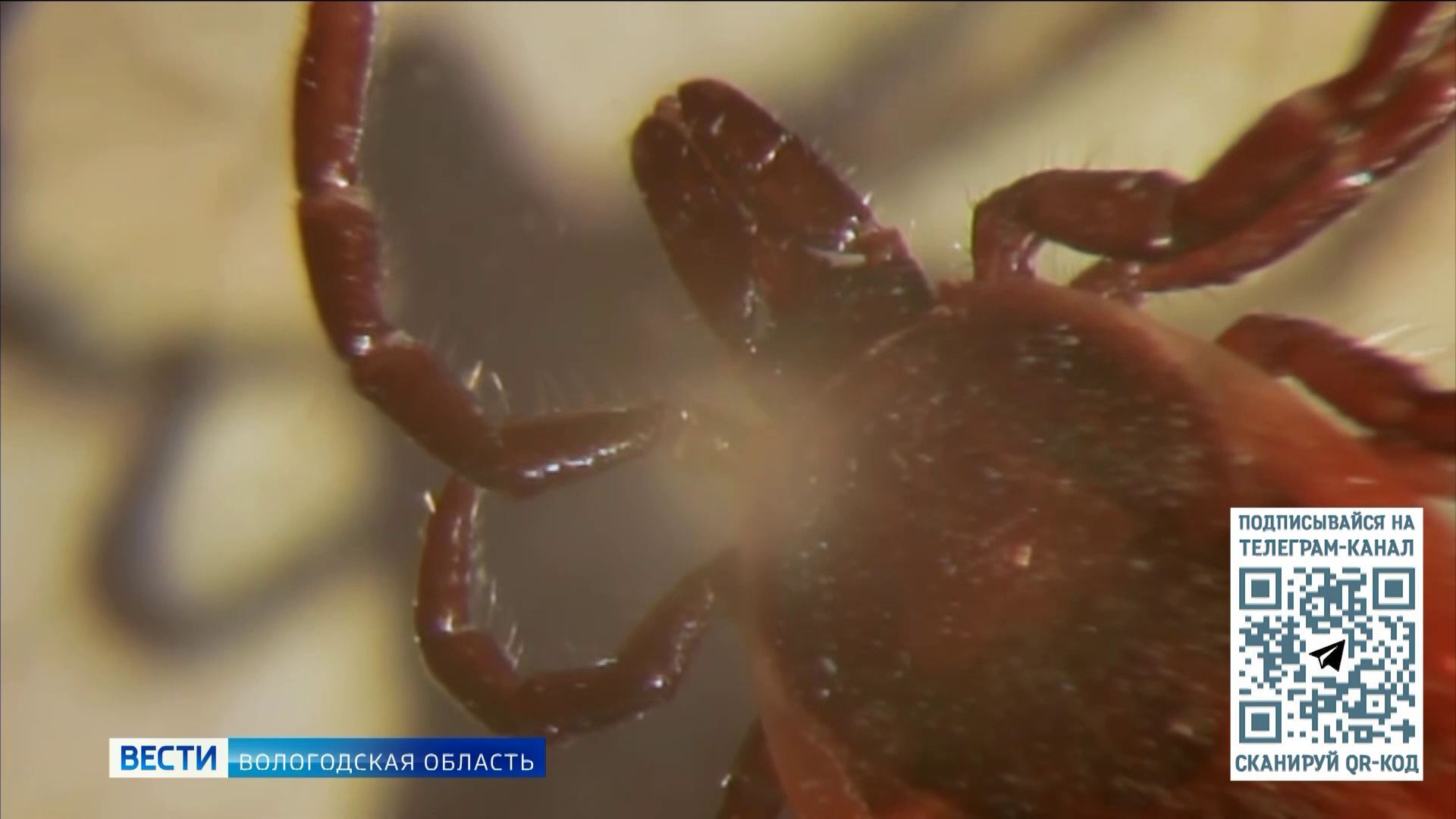 Атака паразитов: в Вологодской области участились случаи укусов клещей