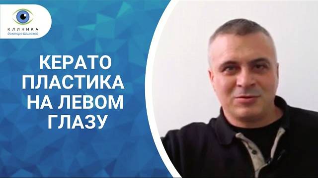 Кератопластика на левом глазу | Отзыв пациента