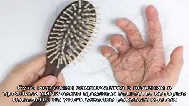 Выпадение волос при онкологических заболеваниях