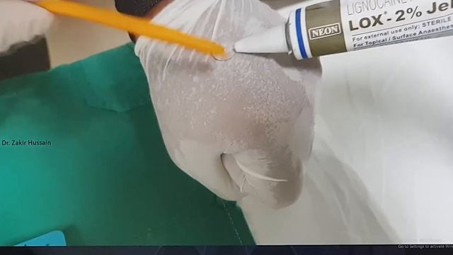 Nose bleed Part 6 (English) Patient teaching programme