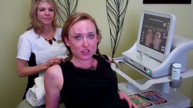 Ultherapy Brow Lift at Sonata Laser Aesthetics