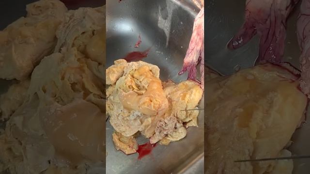 Болезнь яйцевода у курицы/ цисты, перерождение яйцевода