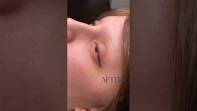 Татуаж стрелок для подростка☺️ до/после ?