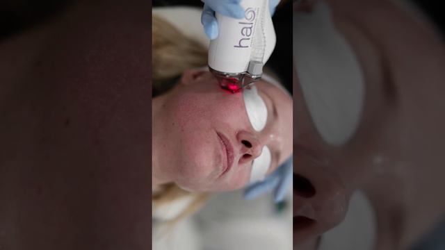 Все, что Вам нужно знать о Halo Laser
