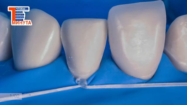 Трюк с флосом для изоляции зубов при помощи  раббердама и открытие цервикальной зоны тефлоном