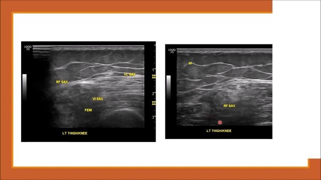 MSK Ultrasound Dr C Weinstein