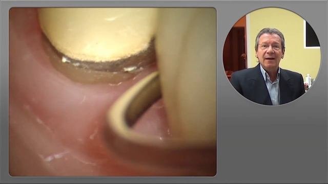 Microscope Dentist - Вступление