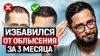 Александр Дзидзария_Мужское облысение - не приговор! Моя ис