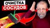 Академики Картавенко_Как не прозевать прорыв сосуда?