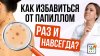 Ирина Баранова. Первая Школа Биохакинга_появляются папиллом