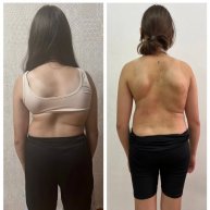 Иконка канала Сколиоз и осанка